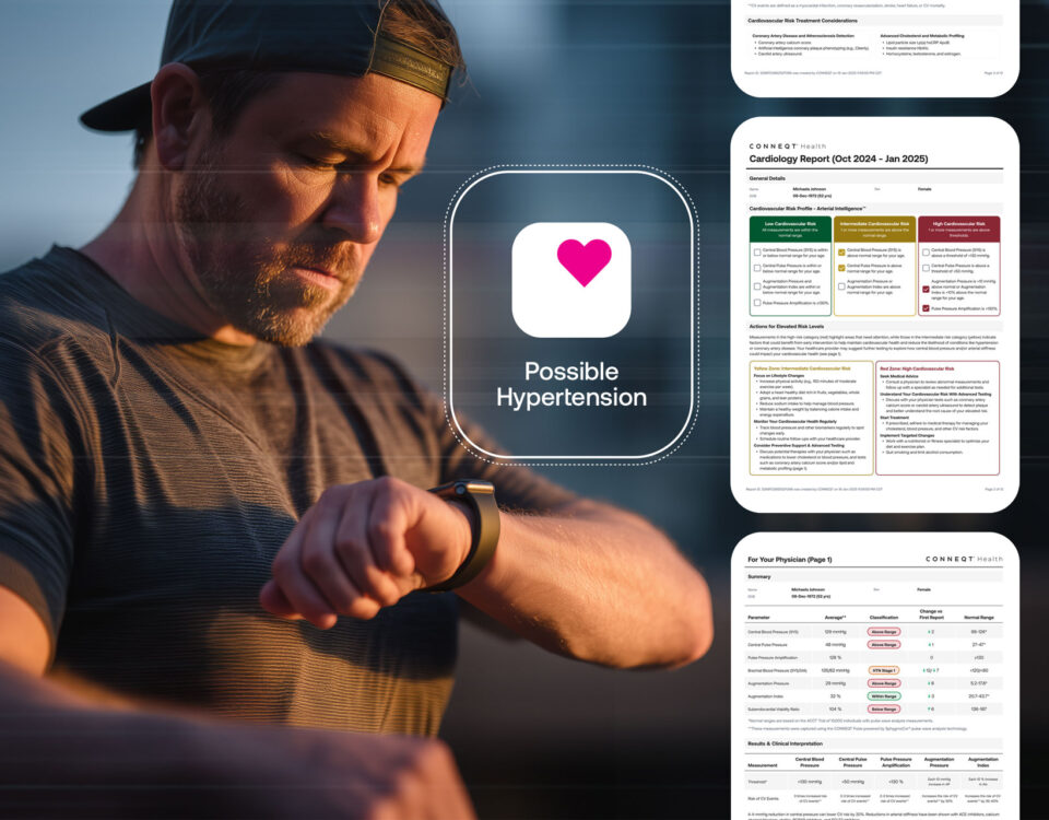 Apple Watch Hypertension Warning Confirmed with CONNEQT Pulse Reports