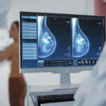 Breast Digital Mamogram