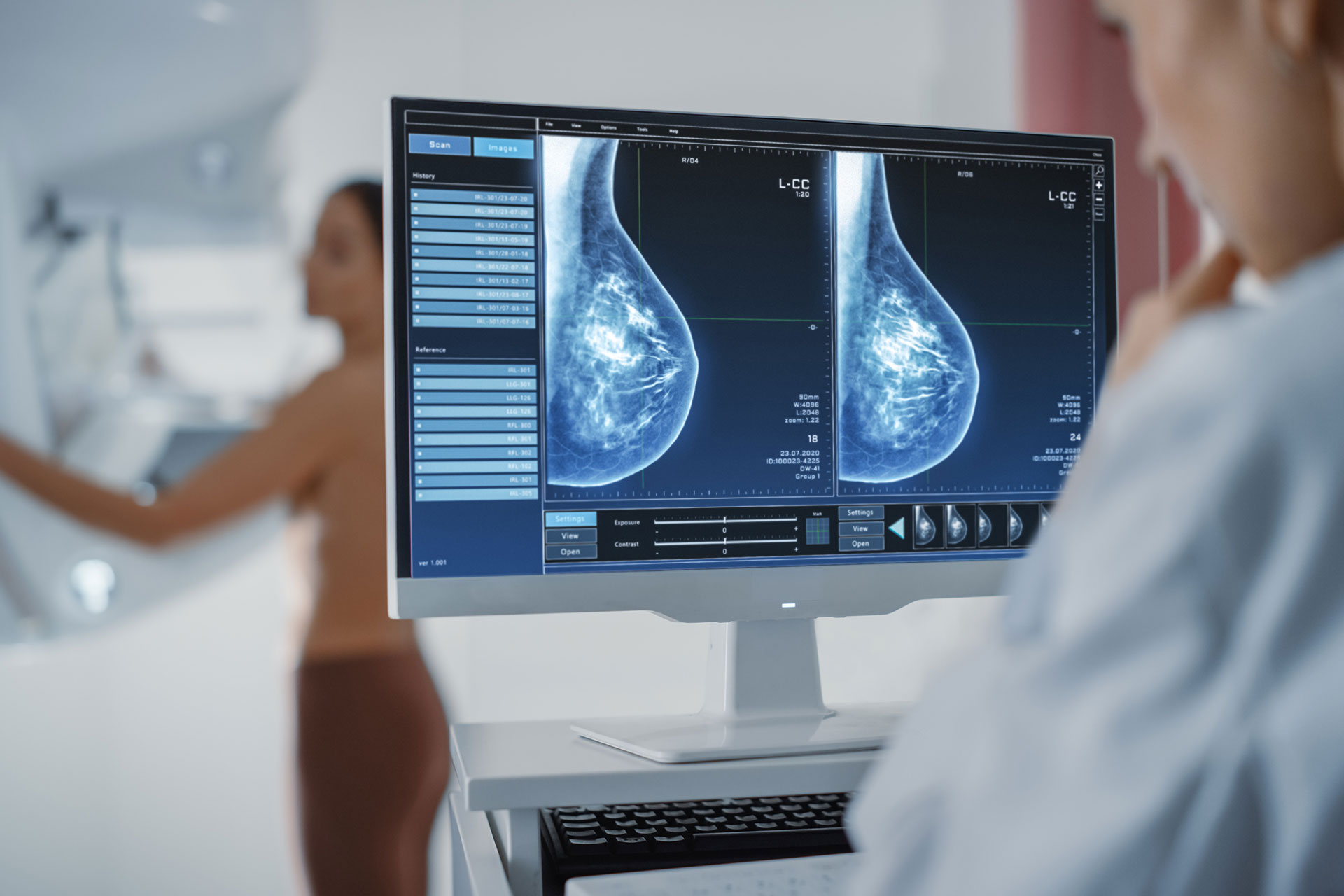 Breast Digital Mamogram
