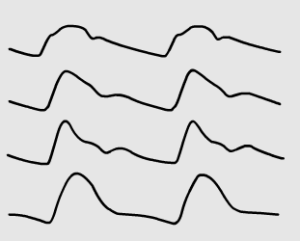 Pulses